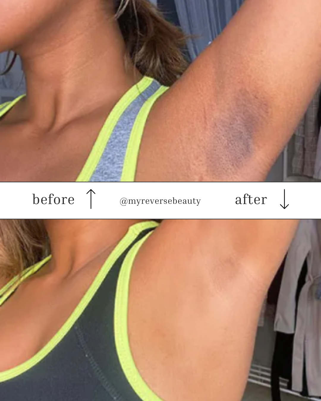 Rejuvenating Body Oil by Reverse Beauty®️ - Reverse Beauty®