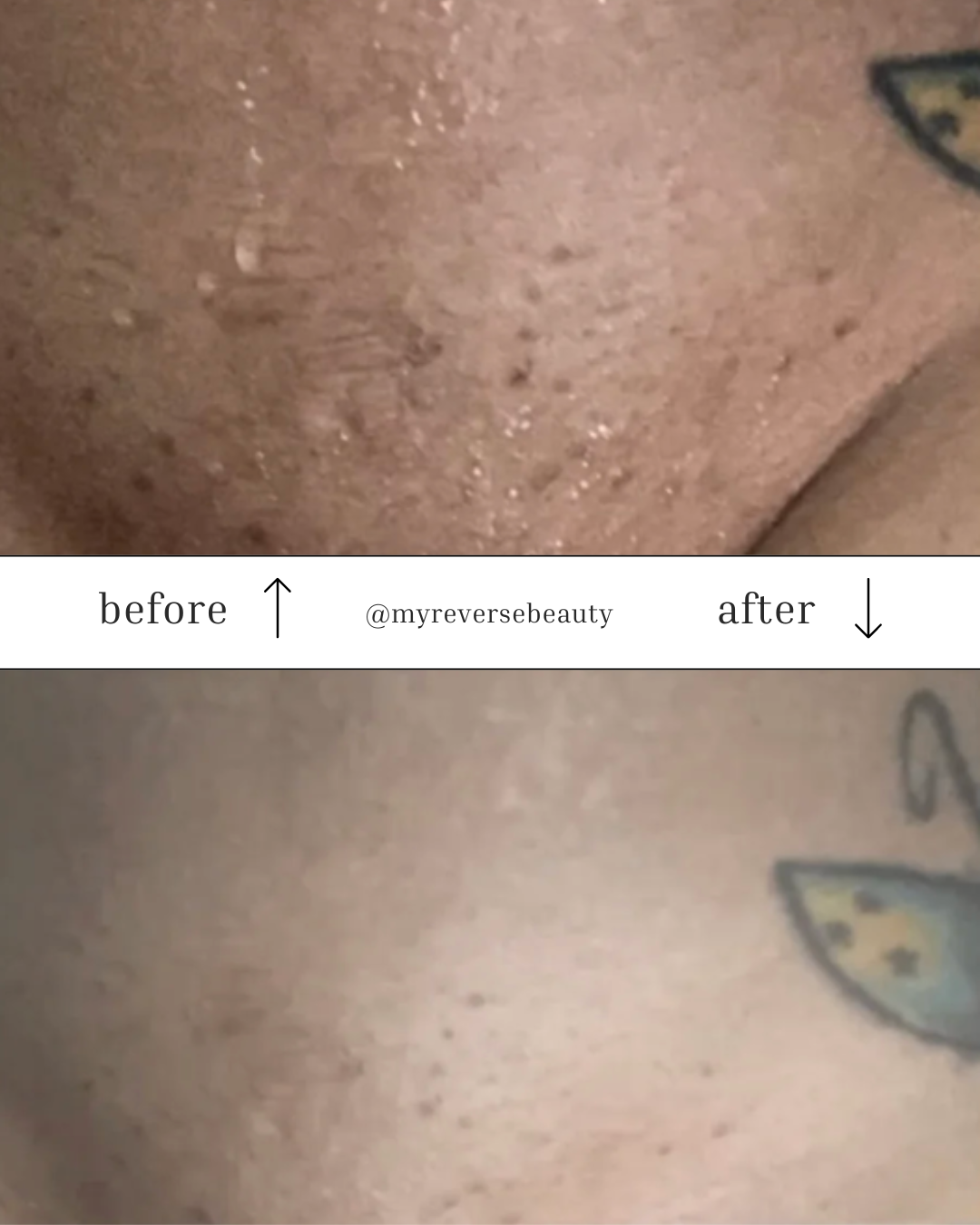 Rejuvenating Body Oil by Reverse Beauty®️ - Reverse Beauty®