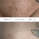 Rejuvenating Body Oil by Reverse Beauty®️ - Reverse Beauty®