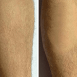 NEW! Quick Shaver by Reverse Beauty®️ - Reverse Beauty®