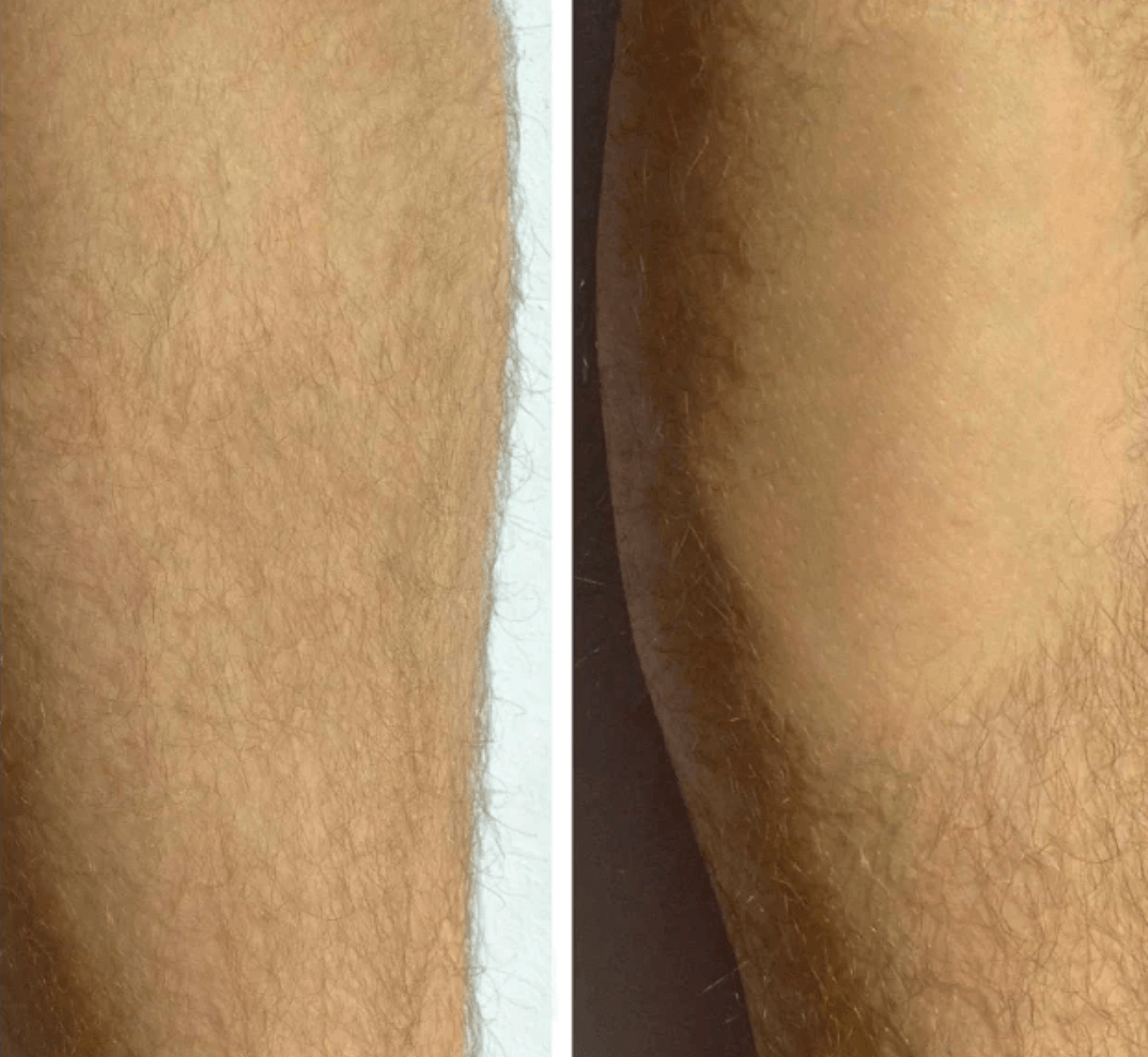 NEW! Quick Shaver by Reverse Beauty®️ - Reverse Beauty®